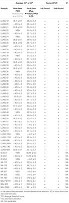 A Real-Time PCR Assay for Detection of Low Pneumocystis jirovecii Levels